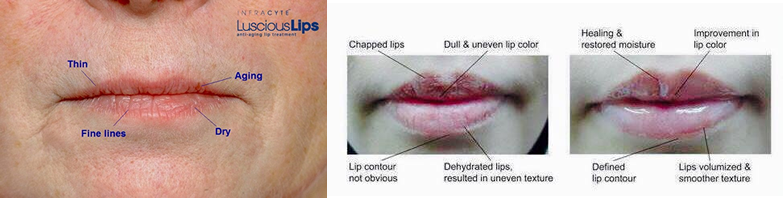 rezultate-lips